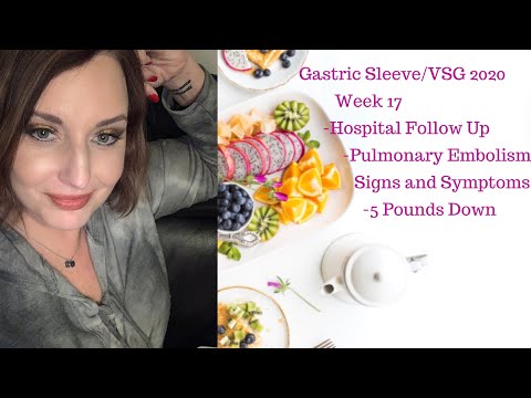Gastric Sleeve/VSG 2020- Pulmonary Embolism and Hospital Follow Up!