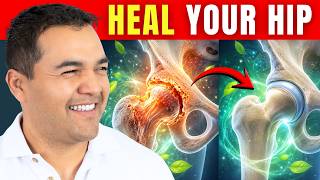 How You Can Reverse Hip Arthritis Without Surgery? (My Approach)