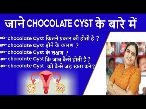 What is Chocolate Cyst, in Hindi Causes and Symptoms, Treatment,  Pregnancy Chances 100%
