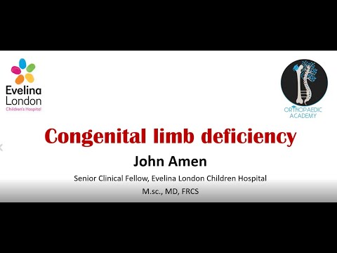 Congenital Limb Deficiencies