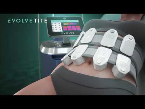 Evolve by InMode Tite Treatment