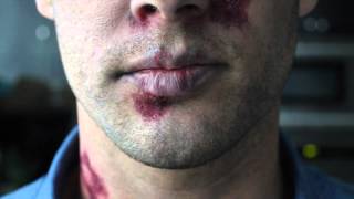 The Face of HIV/AIDS: Then and Now