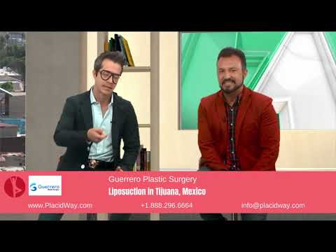 Sculpted Dreams: A Patient's Testimony of Liposuction Performed by Guerrero Plastic Surgery in Tijuana, Mexico