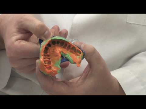 download lagu mp3 mp4 Dental Gold Price, download lagu Dental Gold Price gratis, unduh video klip Dental Gold Price