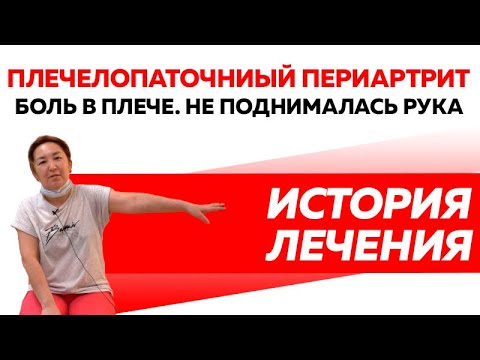 Отзыв Rekinetix. Боль в плече. Не поднималась рука.