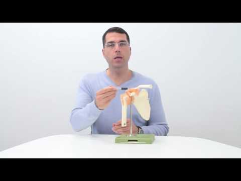 Was ist ein Impingementsyndrom?