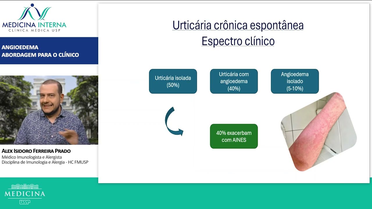 Angioedema - diagnóstico e manejo