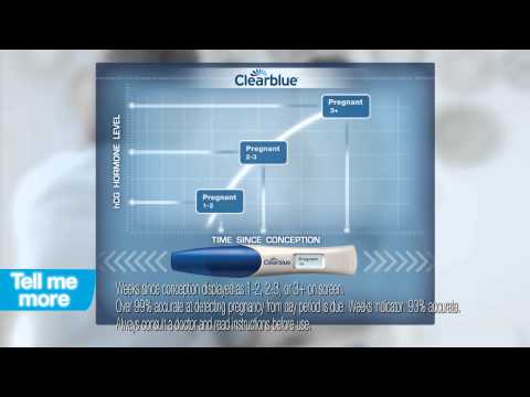 Kabuki khanna Teri galliyan remake by kabuki