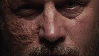 Teaser VF 