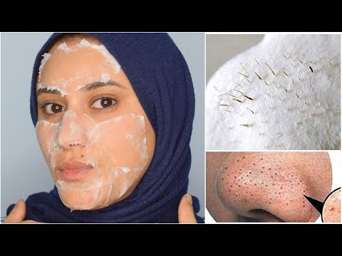 مكون واحد من المطبخ لازالة الرؤوس السوداء و تصغير المسام و شد البشرة ???? هنا hana