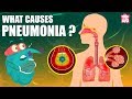 PNEUMONIA | What Is PNEUMONIA? | Respiratory Disease | The Dr Binocs Show | Peekaboo Kidz