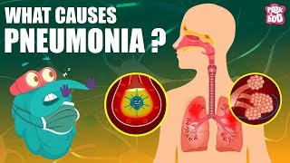 PNEUMONIA | What Is PNEUMONIA? | Respiratory Disease | The Dr Binocs Show | Peekaboo Kidz