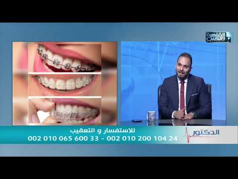 مقابلة — تقويم الأسنان