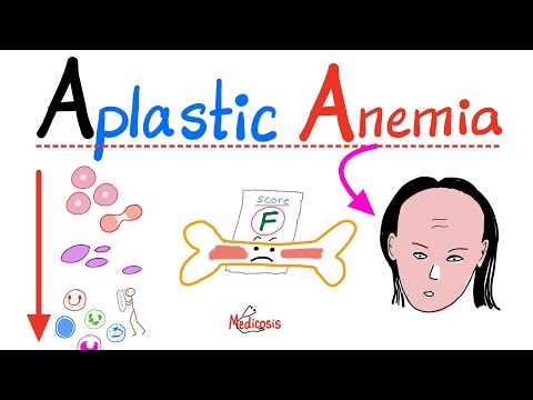 Aplastic Anemia - All you need to know - Definition, Causes, Symptoms, Diagnosis & Treatment