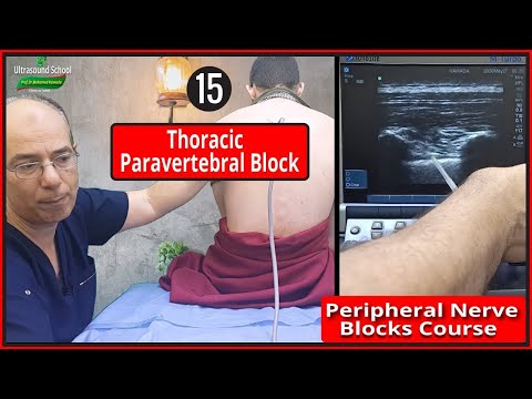Basic Physics of Ultrasound Part 1 Mohamed Hamada 1