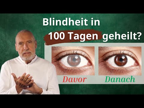 Funktioniert das Augentraining tatsächlich? Erfahrung von Karl Gamper
