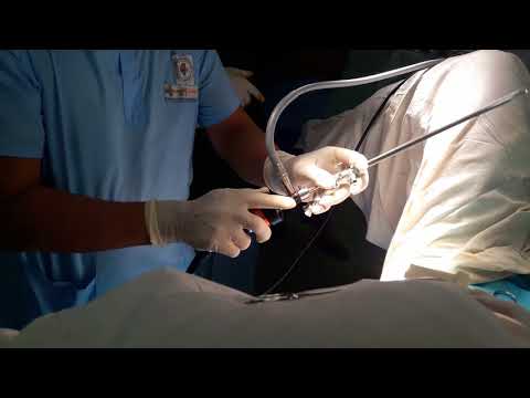 Cystoscope  22 October 2017