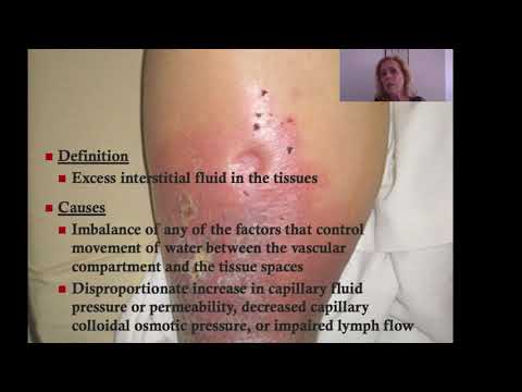 Pathophysiology of Blood Vessels Part 1