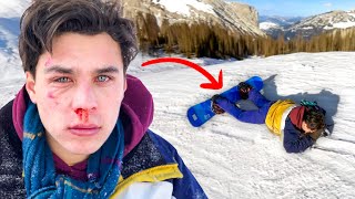 My Worst Snowboard Accident