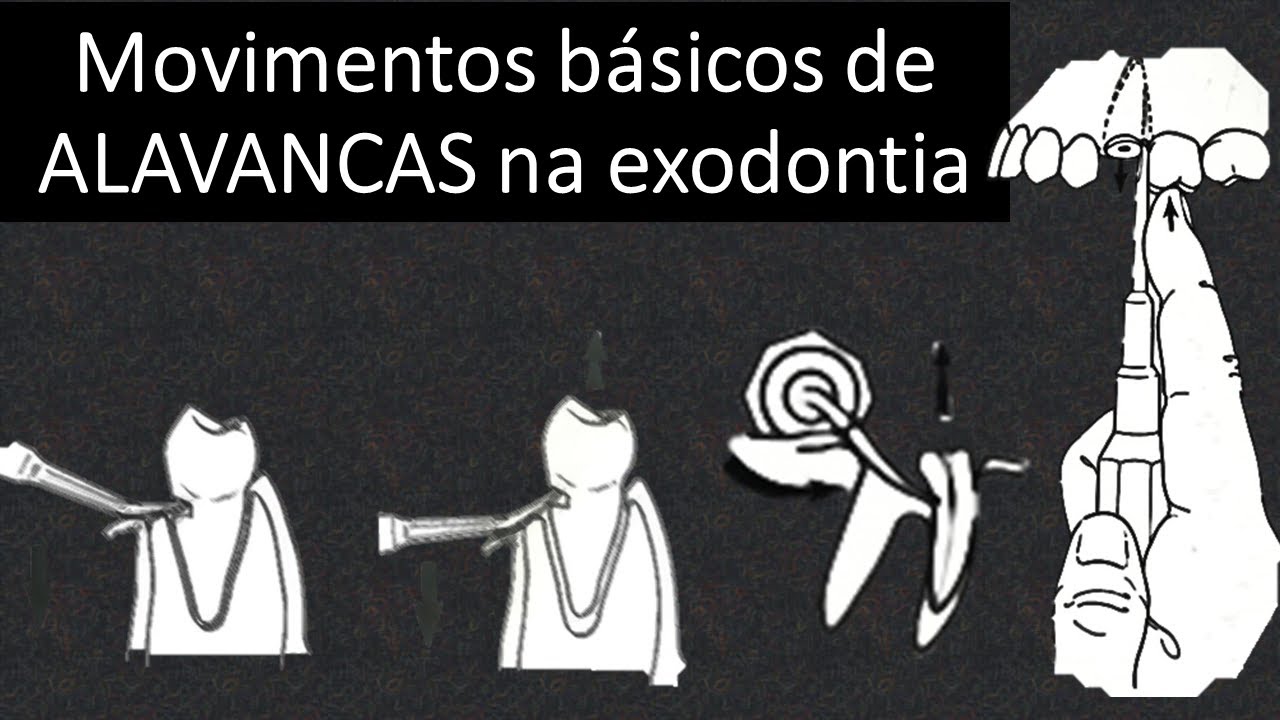 Movimentos básicos de ALAVANCAS na exodontia | Odontologia | Dra Bianca Rosa