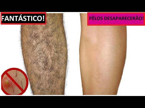 Dicas para remover pelos permanentemente em casa