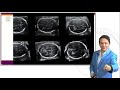 DR ANTONIO LIMAY INTRODUCTION TO OBSTETRICS Ultrasound With Simulator FACULTY OF MEDICINE