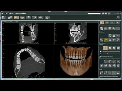 Morita i-Dixel 02 Operation