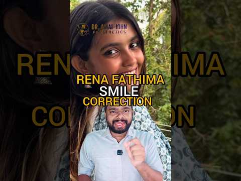 rena fathima bigboss smile correction #arogyam #dentalcare #dentalclinic