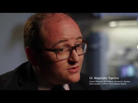 Affirm Prone Biopsy System