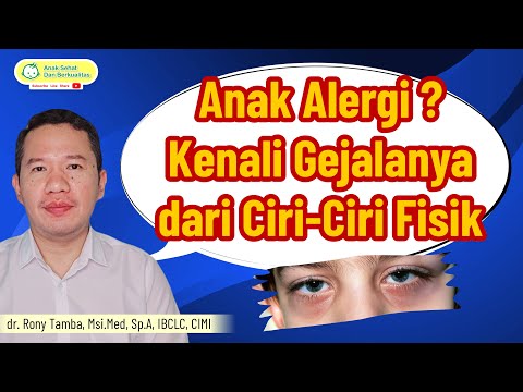 Alergi Pada Anak ? Identifikasi Melalui Ciri Fisiknya | Dr. Rony Tamba, Sp. A