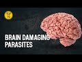 Top 10 parasites that can damage your brain