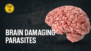 Top 10 parasites that can damage your brain