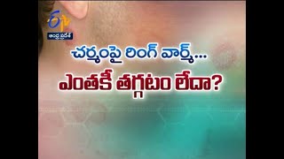 Are you suffering with  ring worm infection? | Sukhibhava | 20th August 2021 | ETV Andhra Pradesh