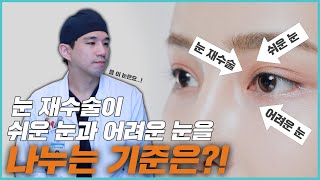 눈 재수술이 쉬운 눈과 어려운 눈을 나누는 기준은⁉️ #눈재수술 #눈재수술잘하는곳