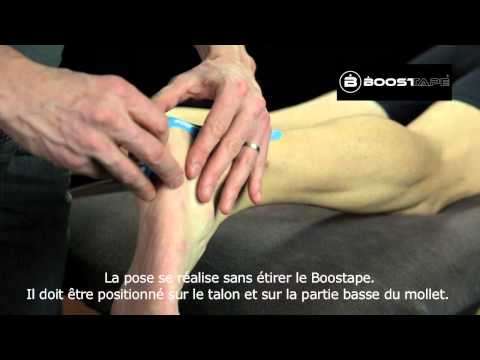 comment soulager un talon d'achille douloureux