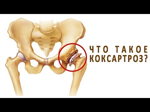 Во время беременности болит правый бок и отдает в спину Народные методы лечения артрита артроза суставов