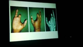 Gillies Oration | APSICON (2013)