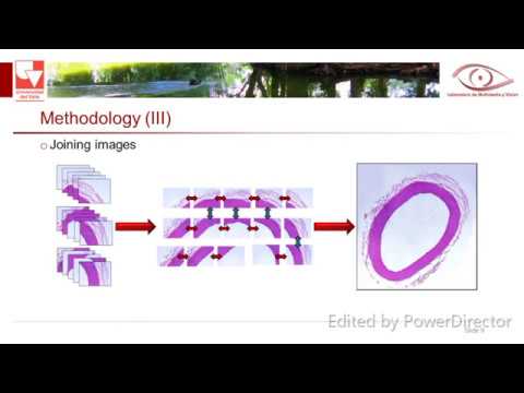 BISCAR: a histological image bank of the human cardiovascular system - Claudia Mazo Vargas