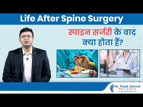 Life After Spine Surgery | Dr Palak Jaiswal