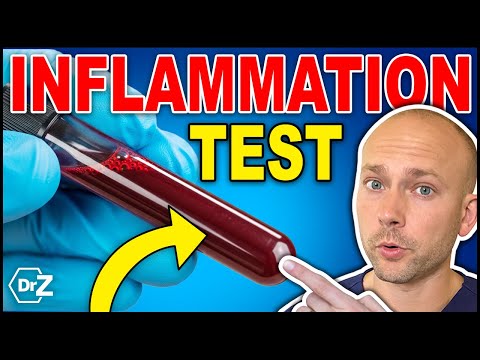 How to MEASURE Inflammation In Your Body - Simple In Home Test!