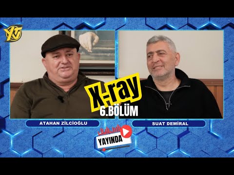 TJK's New Stallion Cotai Glory, it's Tattersalls and Arqana's turn... X-Ray's 6th Episode is out!