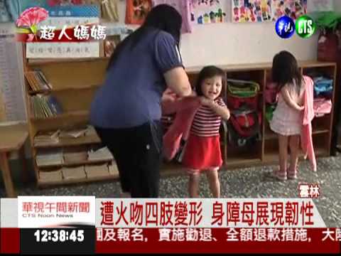 遭火吻.夫離棄 身障母撐家計養2女