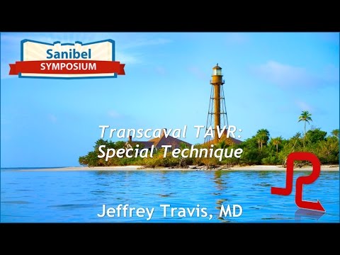 Transcaval TAVR: Special Technique