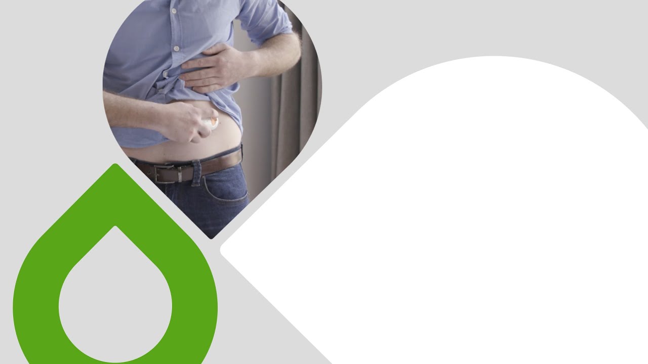 An Overview of the Dexcom ONE CGM System