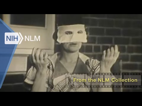 Symptoms in Schizophrenia [Silent] (Pennsylvania State College, 1938)
