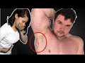 Bodybuilders RAPID MUSCLE GROWTH caused stretch marks