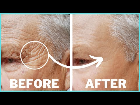 8 Effective Ways to Get Rid of Wrinkles from Your Forehead and Face
