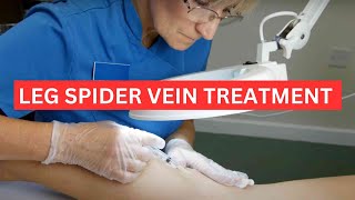 How to Remove Leg Spider Veins and Leg Blue Veins by Microsclerotherapy: A Guide for Doctors Nurses