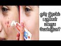 Should Pimples Disappear Overnight | Beauty tips in tamil