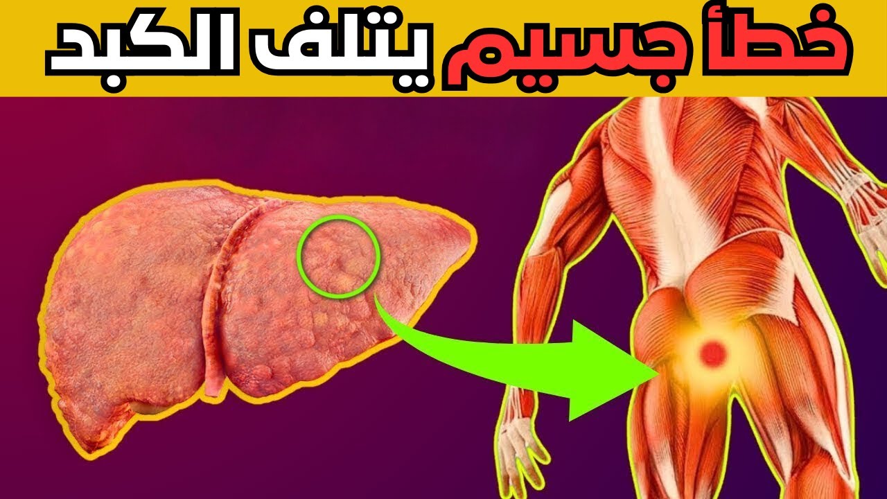 10 علامات غريبة تشير إلى أنك تعاني من تلف الكبد وموت الكبد! معلومات صحية مفيدة.إزالة سموم الكبد،